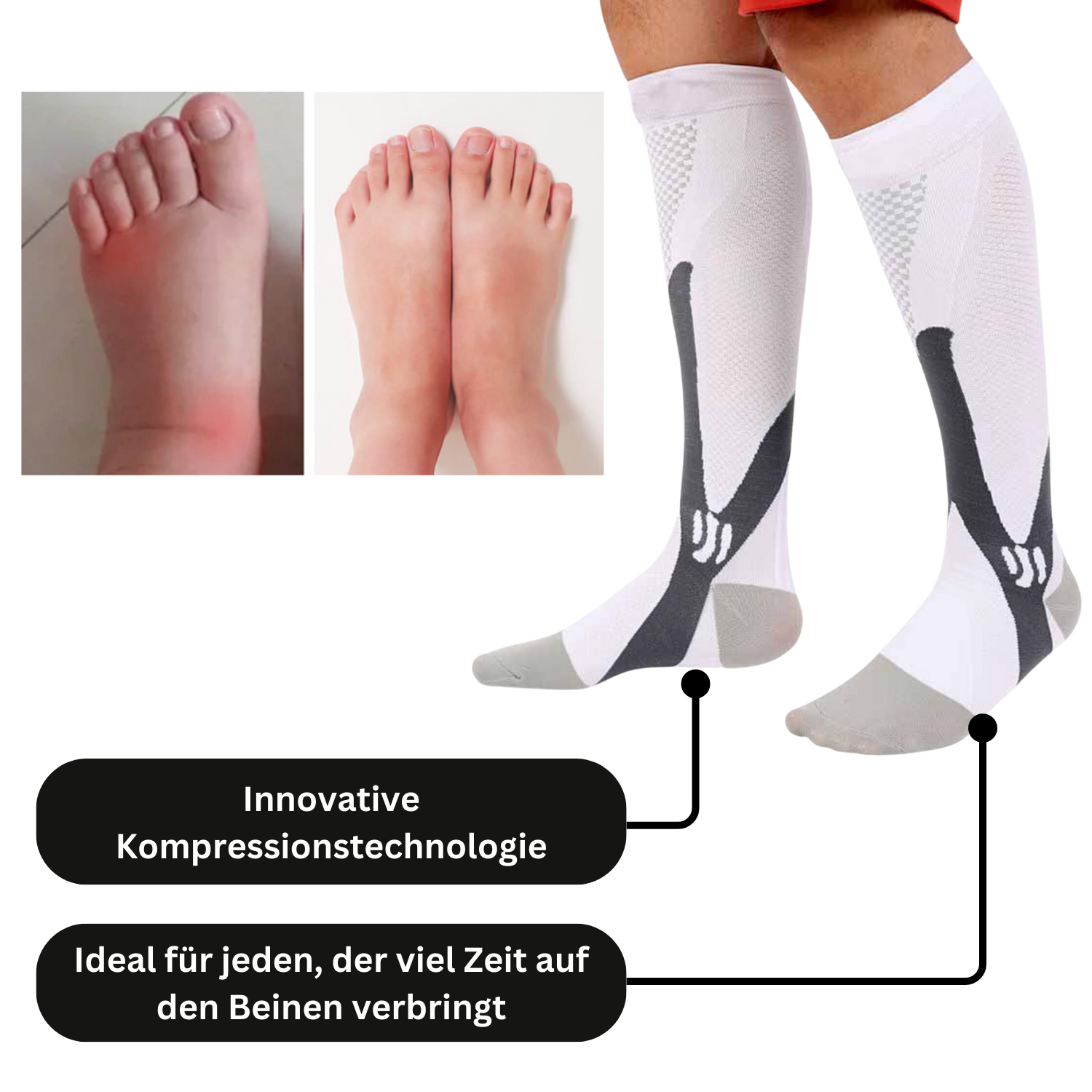 Ein geschwollener linker Fuß und ein normaler rechter Fuß; unten, Beine in weiß Tieberg™️ - Akupressur Kompressionsstrümpfe. Text: Innovative Kompressionstechnologie - ideal für alle, die lange auf den Beinen sind.